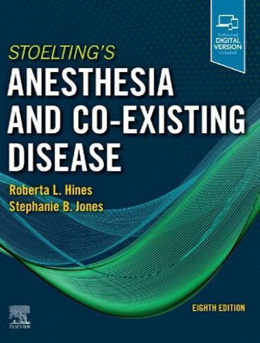 Stoelting's anesthesia and co existing disease 8th edition